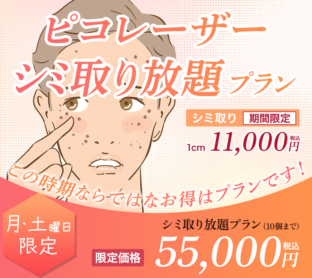 ピコレーザーシミ取り放題プラン