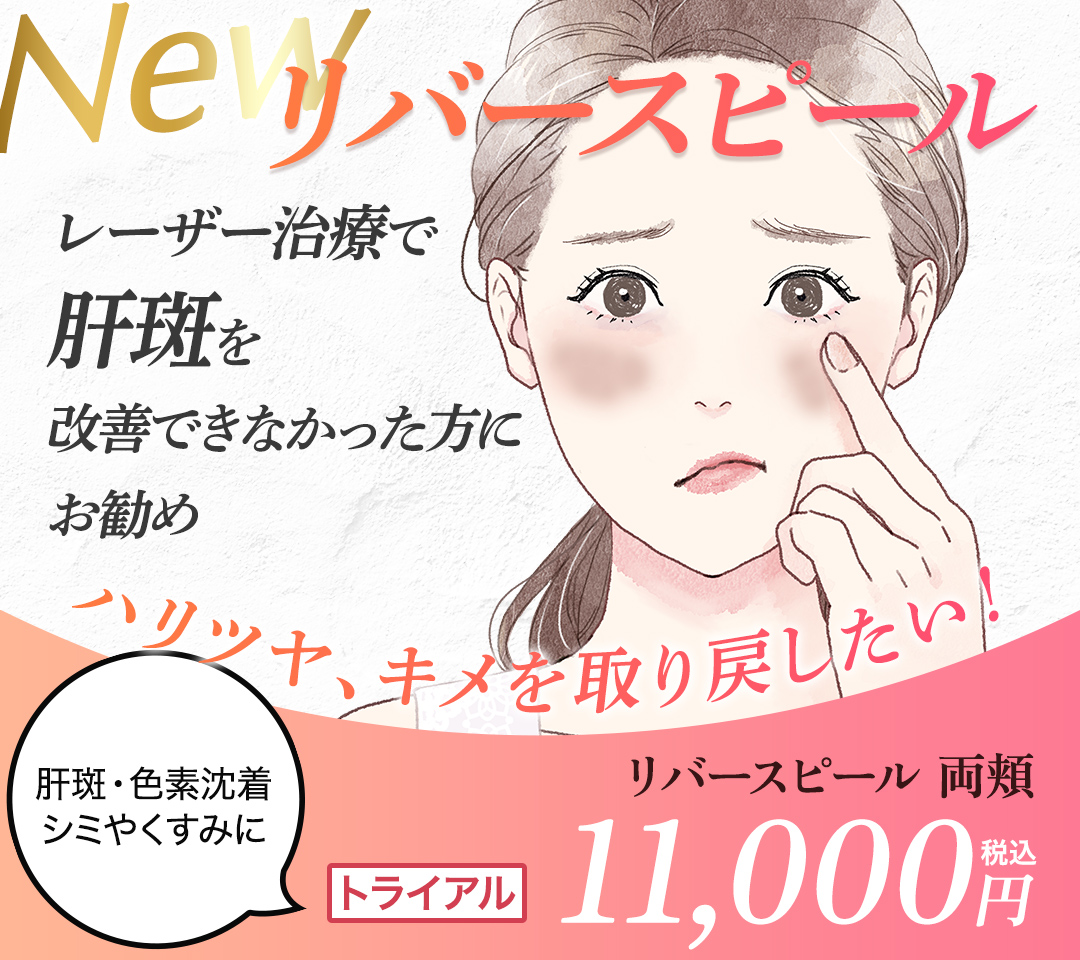 リバースピール