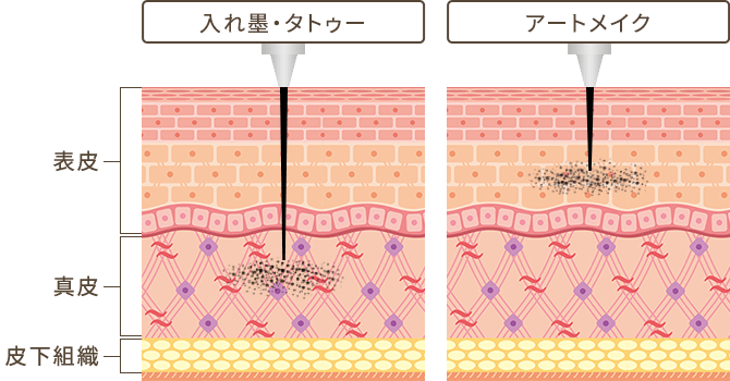 アートメイクとタトゥーの違い