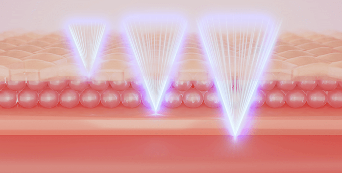 ウルトラセル ジィー（ULTRAcel [zíː]）とは？