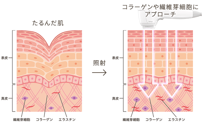 コラーゲンの生成を促し肌を引き締め＆ハリもUP<