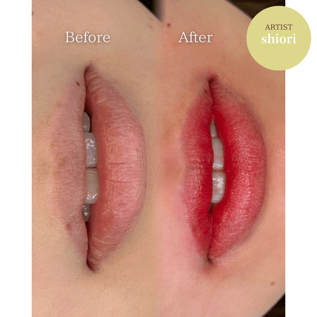 医療アートメイク(リップ)